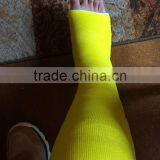 Yellow Fiberglass Casting Tape thumbnail-3