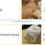 High Intensity Focused Ultrasound Body Fat Burning / Liposunic / Ultrasonic Machine thumbnail-3