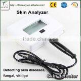 4 Fluorescent Bulbs Portable Skin Care Analyzer Beauty Magnifying Woods Lamp Salon Machine thumbnail-3