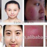 Portable Vascular Removal 980nm Diode Laser Beauty Cosmetics / Laser Diode 980nm Spider Vein Removal Machine thumbnail-6