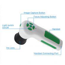 Digital Iriscope 12mp Iridology Camera Eye Iriscope Camera Analyzer thumbnail-4
