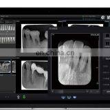 MY-D068-2 Medical Device Rayos x Dental Portatil Portable Intraoral Dental X-ray Film Scanner thumbnail-3