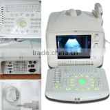 Low Price Portable Ultrasound Scanner 10 inch with Convex probe optional High frequency linear probe RUS-6000A