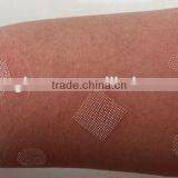 Sanhe Medical CO2 Laser Machine for Stretch Mark Removal With CE thumbnail-6