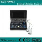 China factory low price mini laptop portable ultrasound scanner medical price for obstetrics and gynecology examine from china