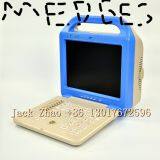 Portable Color Doppler Laptop Ultrasound, Dw-C60 Ultrasonic Machine thumbnail-5