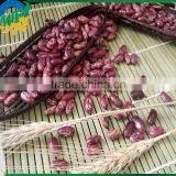 Chinese Purple Speckled Kidney Beans for Sale thumbnail-2