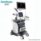 Trolley Medical Doppler Ultrasound Sonoscape S40 Price thumbnail-4