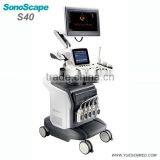 Trolley Medical Doppler Ultrasound Sonoscape S40 Price thumbnail-5