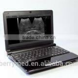 Low Price Portable Ultrasound Machine, Mini Laptop Ultrasound Scanner thumbnail-2