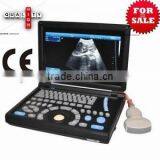 High Quality Cheap Price of Handheld/Notebook/Laptop Ultrasound Scanner/machine With Convex, Linear, Vaginal, Rectal Transducer- thumbnail-1