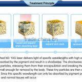 Q Switch Laser Tatoo Removal / nd Yag Laser / Eyebrows / Age Spot Removal thumbnail-6