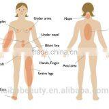 2016 New 808 Diode Laser Hair Removal Machine/hair Removal Speed 808/808nm Fast Hair Removal Laser Machine thumbnail-6