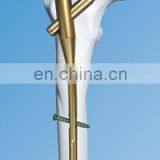 Orthopedic Trauma Implants PFNA thumbnail-2