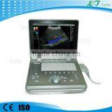 LTC5 Portable Hand Carried Laptop Color Doppler Ultrasound Machine