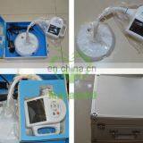 MY-G061 Hot Sale Infrared Angiograph / Medical Portable Vein Finder thumbnail-2