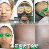 Distributors Needed Q-Switched Nd. Yag Laser Facial Veins Treatment Tattoo Removal Skin Rejuvenation Machine D006 1500mj thumbnail-6