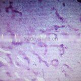 Fibrous Hyperplasia of Bone Sec. Oral Histology Pathology Parasitology Prepared Slides thumbnail-2