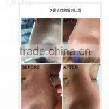 Beauty Salon Machine Water Oxygen Jet thumbnail-5