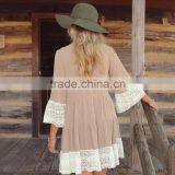 Zm50314b Europe Hot Sale Round Neck Ladies Clothes Loose Lace Short Dress thumbnail-2