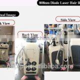 2016 Cheapest 808 Diode Laser / Diode Laser Hair Removal Machine Manufacturer thumbnail-6