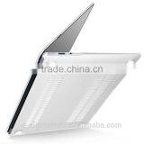 Matt Hard Fashion Colorful Tablet Cover PC Case for MacBook Pro 15 Retina