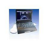 BELSON 3000M Laptop Ultrasonic Diagnostic System Image Mode B, B + B, 4B, B + M, M