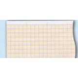 1-Conduct Electrocardiograph Paper