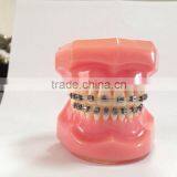 Dental orthodontic bracket self ligating