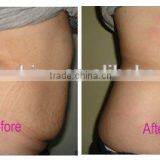 HOTTEST Kim 8 New Ultrasonic Liposuction Equipment Cavitation Rf Vacuum Slimming Machine Weight Loss Equipment Slimming Machine thumbnail-3