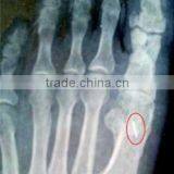 China KND-A/F CE Medical Dry Film Agfa Healthcare thumbnail-3