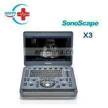 Cheap Medical Sonoscape x3 Ultrasound Machine/Laptop Ultrasound Scanner/Portable Ultrasound Probe thumbnail-3