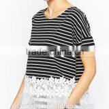 Stripe Blouse With Floral Lace Hem Fashion Design Lady Blouse thumbnail-4