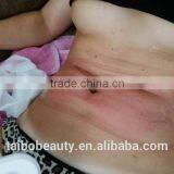 Fat Reduction Greece Hot Sell Best Cryolipolysis Fat Freezing Machine For Sale Body Shaping thumbnail-5