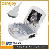 18 month warranty clinic diagnostic equipment portbale ultrasound scan machine