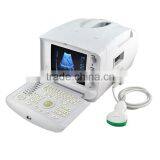 High Quality Portable Veterinary Ultrasound Equipment/portable Diagnostic Ultrasound Price thumbnail-3