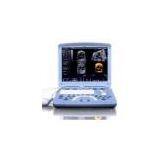 GE Voluson 1 Portable Ultrasound Machine thumbnail-1