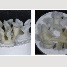 Digital-Crowns-Bridges Dental Laboratory in China thumbnail-2