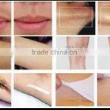 Skin Cooling Machine for Laser Hair Removal Machine thumbnail-6