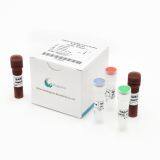 COVID-19 (SARS-CoV-2) Nucleic Acid Test Kit thumbnail-1