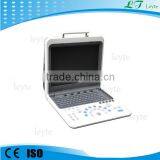 LT5100 Full-digital Portable Color Doppler Ultrasound Diagnostic System