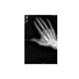 Medical One-side Dry Film(CT-8) thumbnail-1