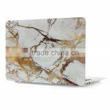 Marble Case Covers for Macbook Pro 13"/15", Hot Stylish Case for Macbook Pro thumbnail-2