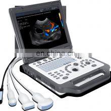 High Quality Products Veterinary Ultrasound Portable Full Digital Beam-former Diagnosis & Injection Seamaty 6.0kg SD1