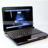 Low Price Portable Ultrasound Machine, Mini Laptop Ultrasound Scanner thumbnail-1