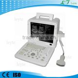 LTS-4 CE medical handheld ultrasound device