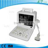 LTS-4 CE Medical Handheld Ultrasound Device
