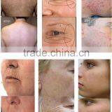 Skin Care Multifunctional 3 Handles Maquina Ipl Depilacion Laser Ipl Beauty Salon Equipment Ipl Hair Removal Machine With Factory Price Skin Tightening thumbnail-3