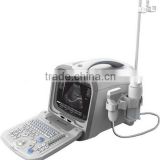 Portable Digital Ultrasound Scanner price