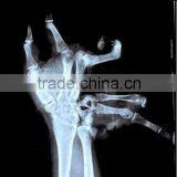 Fuji Dihl /medical Surgical Film/xray Medical Dry Laser Imaging X-ray Film thumbnail-6